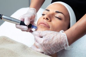 Micro needling: What It Is, Uses, Benefits & Results